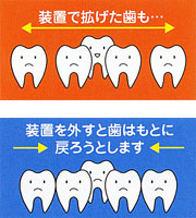 床矯正